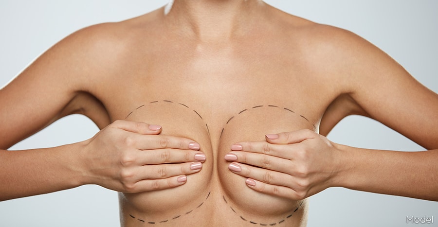 Embark on Your Path to Radiant Curves: Breast Augmentation in Miami post thumbnail image