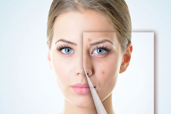 Your Journey to Radiant Skin: IPL Therapy Nearby post thumbnail image