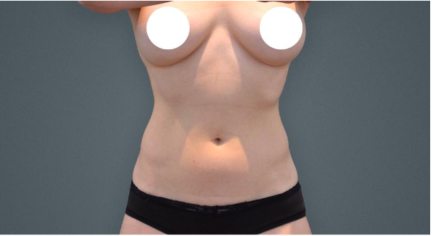 Unveiling the Beauty of Levant Cosmetic Surgery post thumbnail image