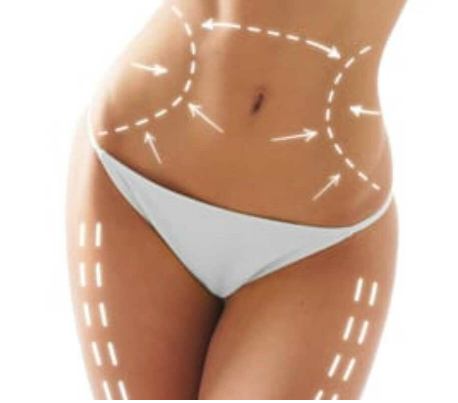 Revolutionizing Your Figure: The Tummy tuck Miami Experience post thumbnail image