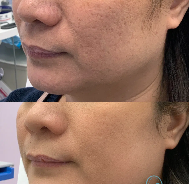 The Art of Scar Treatment: Reclaiming Your Skin Confidence in Edmonton post thumbnail image